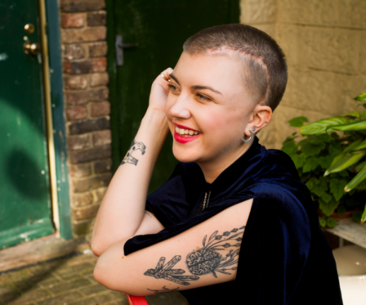 A young woman with a scar on the side of her head smiles while having a conversation.