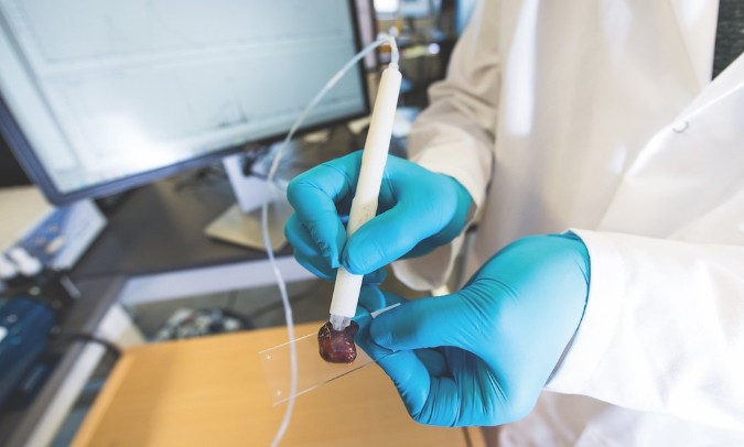 A surgeon uses the MasSpec pen to test tissue,