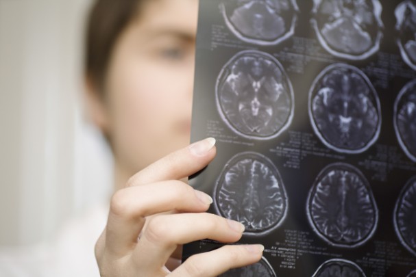 A doctor studies brain scans 