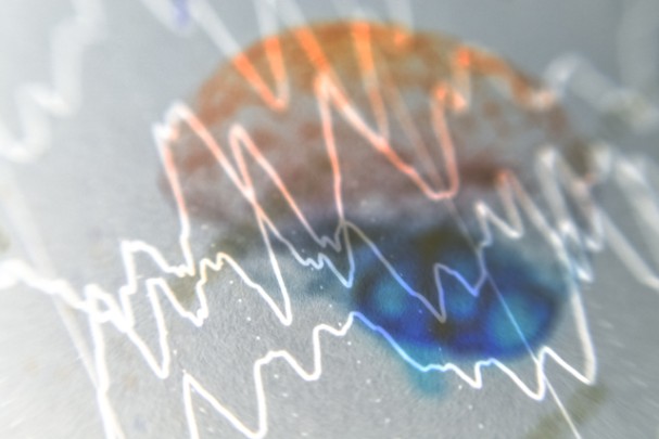 A chart shows brain waves. 