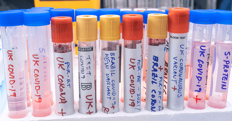 A set of tubes containing different COVID-19 variants.