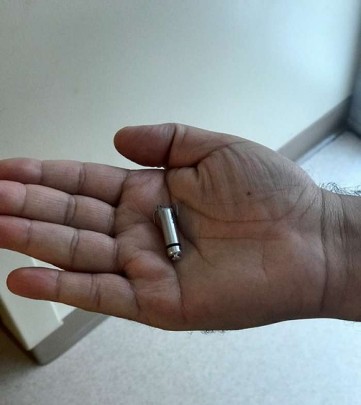 World’s Smallest Pacemaker Successfully Implanted | St. Luke's Health
